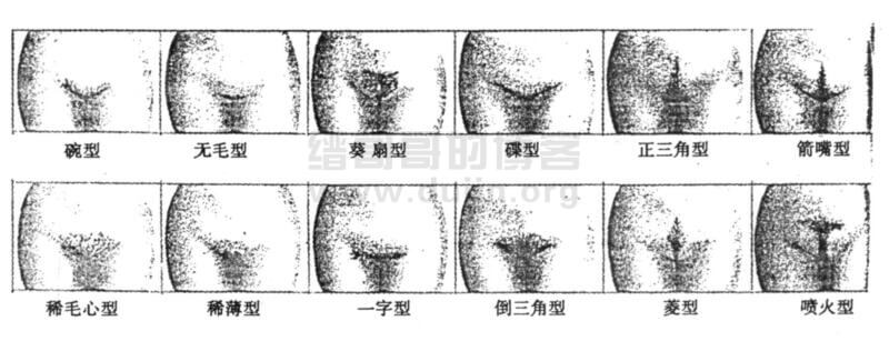 图为女性阴毛的十二种类型 图为女性阴毛的十二种类型