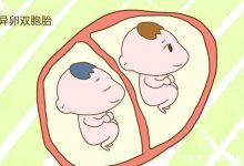 段子成真,双胞胎儿子被鉴定同母异父,一次怀上两个男人的种-缙哥哥